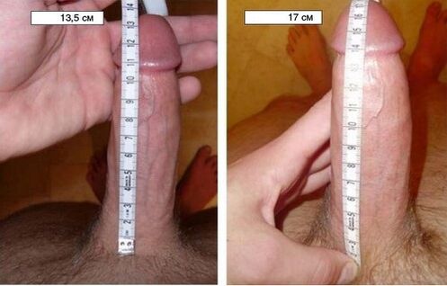before and after penis pump enlargement