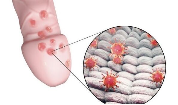 penis enlargement gel allergy